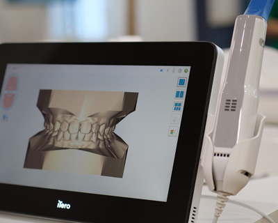 最新機器iTeoを用いて患者様の負担が少なくインビザライン矯正の歯型をとることができます。